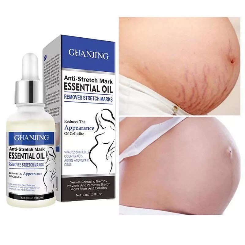 Guanjing Anti Stretch Marks Serum